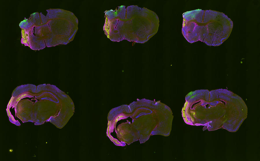 InfarQuant cropped starting slide for preprocessing setup